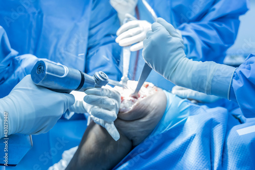 Selective focus with blurred background.Orthopedic surgeon in blue surgical gown suite using saw to cut the bone while total knee replacement surgery in osteoarthritis patient.Team of surgeons.