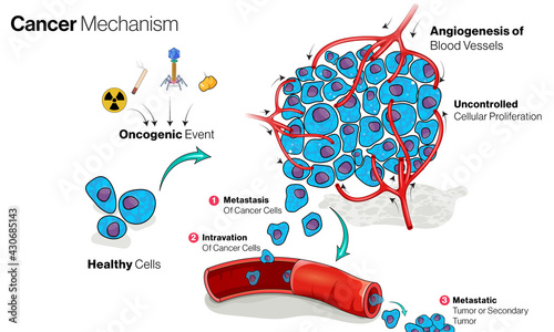 Illustration of Tumor formation process.