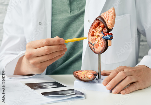 Urology and treatment of kidney disease. Doctor analyzing of patient kidney health using kidney ultrasound and anatomical model