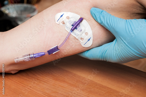 Doctor checks the PICC line on the arm of a woman undergoing chemotherapy for breast cancer