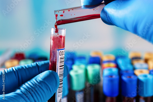 technician working in laboratory with blood samples to stain smear and slide. The lab technician who mixes the blood sample in different tubes can contaminate the samples