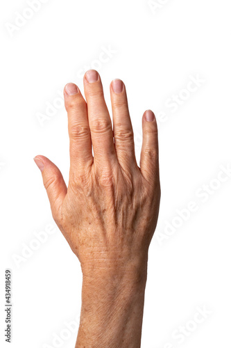 Hand of elderly Caucasian woman with Heberden's arthritis at the index finger on white background. Deformity of finger due to bony swellings in distal interphalangeal joint. Sign of osteoarthritis.