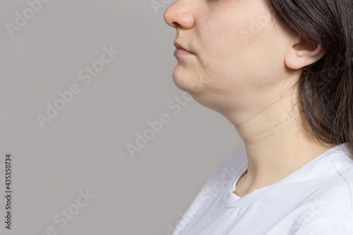The woman has a double chin. Treatment, chin reshaping, fat removal, lifting. Place for text copy space.
