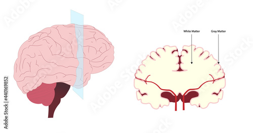 Cerebral coronal section view. Inside of the brain perspective. White and Gray Matter anatomy 