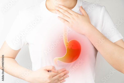 Gastroesophageal reflux disease (GERD) or acid reflux symptoms. Woman suffering from heartburn, stomachache, nausea and bloating. Gastrointestinal system disease and digestive problems.