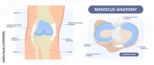 patella pain cap knee tear Torn injury Swelling bone leg exercise muscle jumper's runner's bursitis tendon tibia Anterior Cruciate Ligament ACL sport femur painful it band rupture Trauma joint cyst