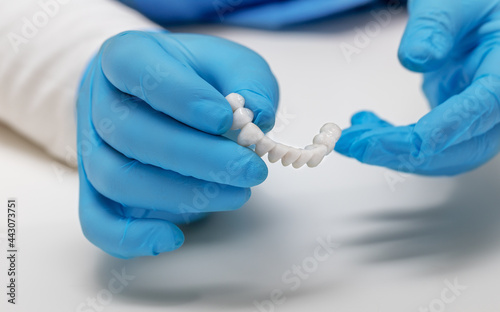 dentist holds ceramic dental crowns in his hands, zirconium bridge, close-up