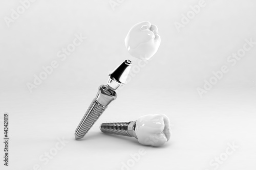 Detail of a false tooth implant fixed