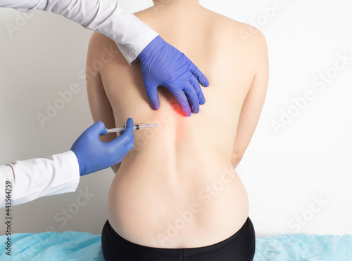 The doctor injects an ozone-oxygen mixture into the back of a girl to a patient to treat diseases of the spine and relax the muscles of the back. Modern method of ozone therapy, thoracic spine