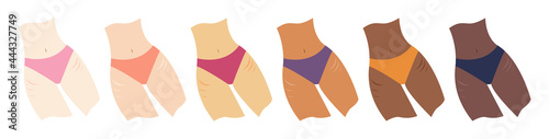 Female bodies with stretchmarks in tights. Women of with different shades of skin color in underwear with striae on legs. Body positivity, beauty, skincare concepts