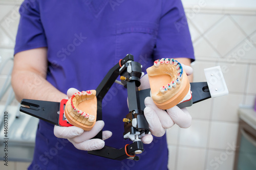 model of the jaw in the articulator in the hand of a young doctor. The dentist shows the unfolded articulator