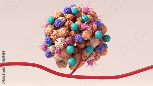 Tumor microenvironment, normal cells, molecules, and blood vessels that surround and feed a tumor cell. Microenvironment can affect how a tumor grows and spreads.