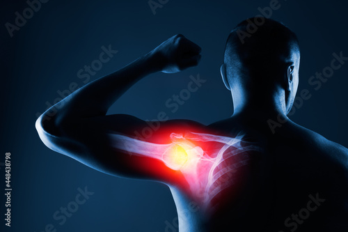 Human shoulder joint in x-ray on blue background. Shoulder joint is highlighted by yellow red colour.