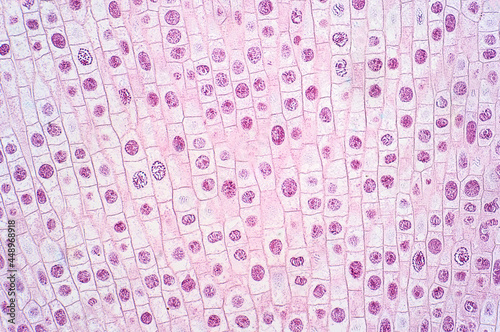 Mitosis cell of root tip of onion under the light microscope.