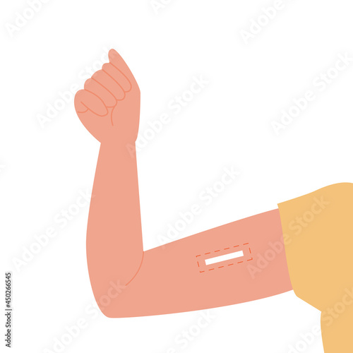 Contraception method. Vector flat female arm with inserted contraceptive implant. Birth control for women and pregnancy prevention. Illustration.