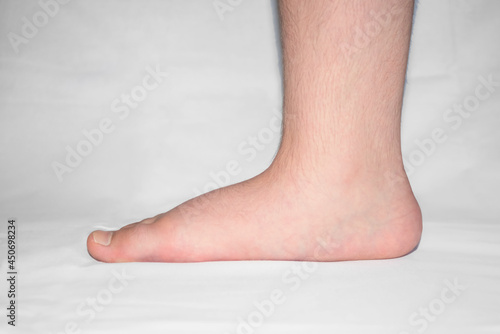 Close up of mans bare foot with strong flat feet also called pes planus or fallen arches.