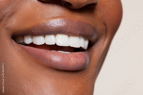 Close up of female toothy smile