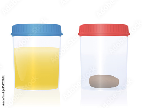 Urine and fecal sample in specimen cups with blue and red cap for urological analysis and medical examination. Isolated vector illustration on white background. 