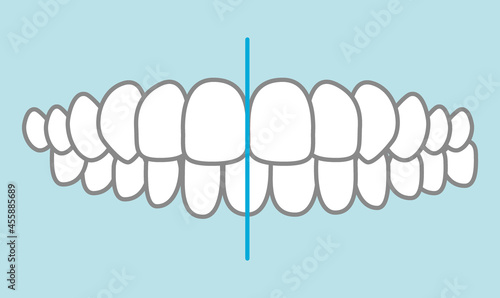 歯並びのイラスト