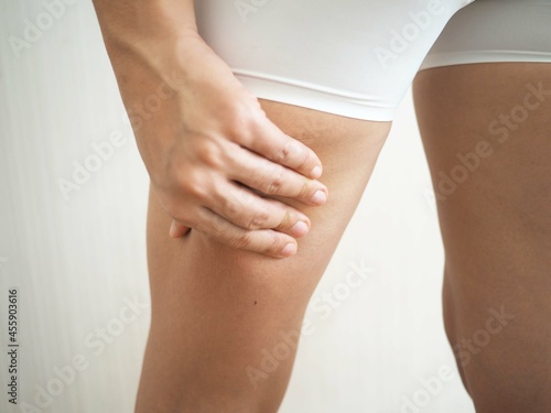 Checking cellulite woman thigh, beautiful female body legs, perfect figure on white background. closeup photo, blurred.