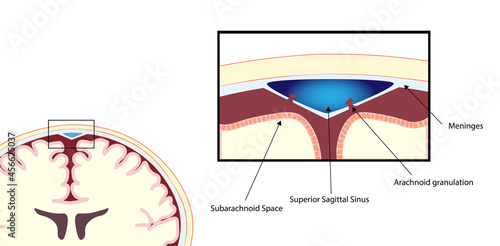 Superior Sagittal Sinus coronal section anatomy 