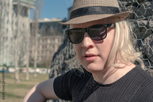 Close-up of a young albino man wearing a hat and dark glasses to protect himself from the sun.