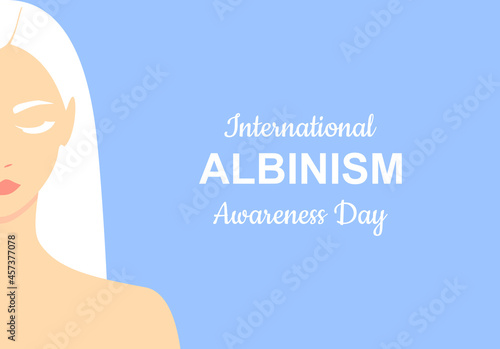 Beautiful albino woman with closed eyes on a soft blue background. International albinism awareness day 