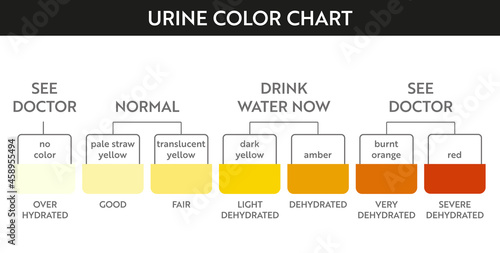 Urine color chart. Pee hydration and dehydration test strip. Vector design for medical education poster.