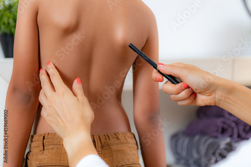 Pediatric doctor examining posture of a boy, making marks on his back, checking angle of scapula bones.