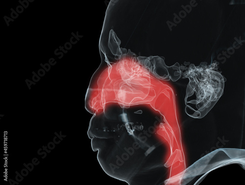 Anatomy of paranasal sinuses and trachea airway 3D illustration .