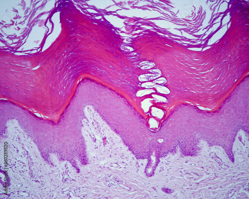 Thick skin. Strata of the epidermis