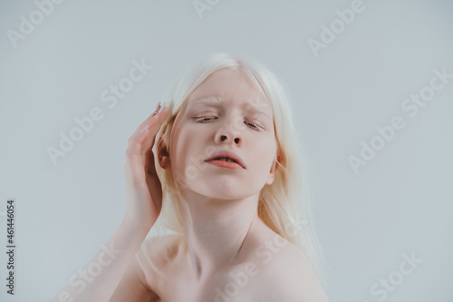 Beauty image of an albino girl posing in studio wearing lingerie. Concept about body positivity, diversity, and fashion