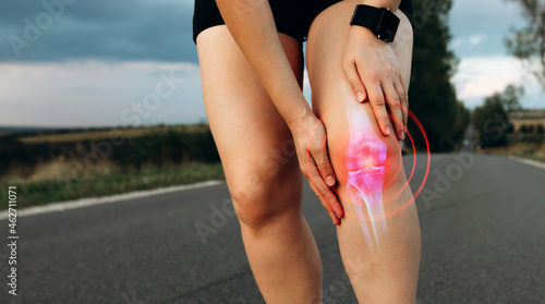  Joint problems and tendon inflammation. Sporty woman who suffered a knee accident during the run. 