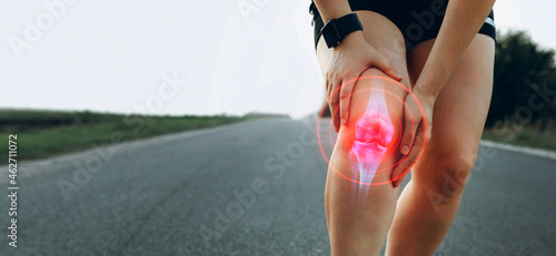  Joint problems and tendon inflammation. Sporty woman who suffered a knee accident during the run. 