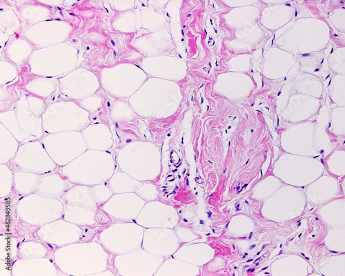 Adipose tissue