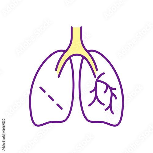 Lungs surgery RGB color icon. Medical operation. Cancer surgical treatment. Pulmonary manipulation. Respiratory rehabilitation. Isolated vector illustration. Simple filled line drawing