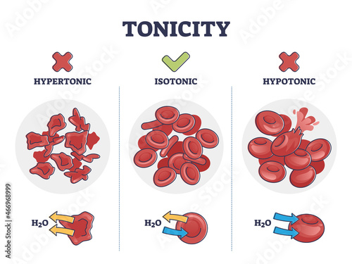 Tonicity as osmotic hypertonic, isotonic, hypotonic pressure outline diagram. Labeled educational comparison with water concentration in red blood cells vector illustration. Liquid exchange balance.