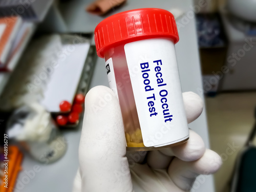 Fecal occult blood test (FOBT). Doctor holding sample container with feces or stool for occult blood test (OBT).