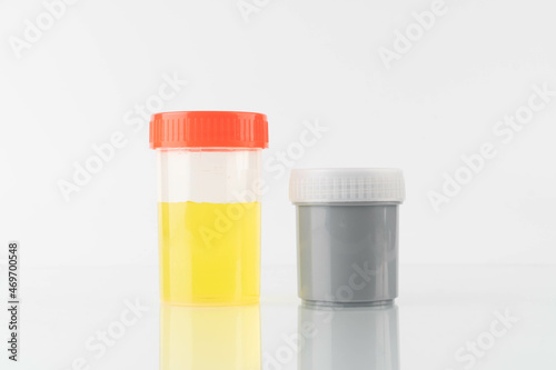 Yellow color urine sample and stool container specimen bottle for check signs of common conditions or diseases on white background.