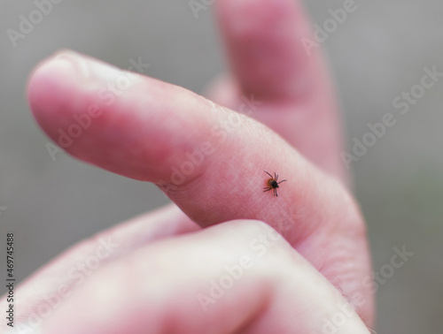 Tick season. Lyme disease - caused by tick bites.