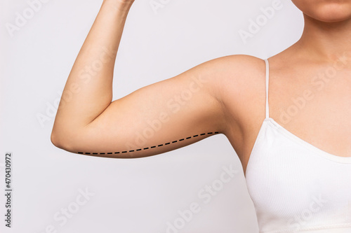 Cropped shot of a young woman with excess fat on her upper arm with marks for liposuction or plastic surgery isolated on a gray background. The loose and saggy muscles. Overweight. Beauty concept