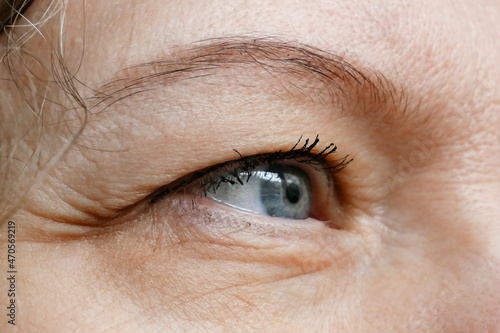 middle-aged woman does corrective eye makeup to correct the drooping eyelid. Ptosis is a drooping of the upper eyelid, lazy eye. Cosmetology and facial concept