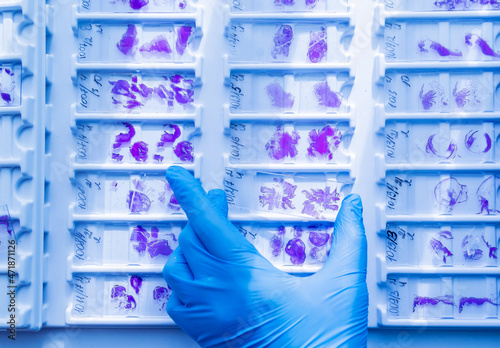 Hand in blue glove holding glass histology slides