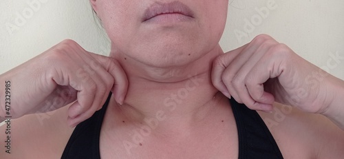 Under the chin of a woman has sagging skin.