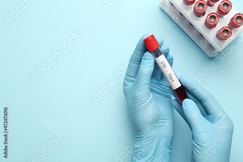 Scientist holding tube with blood sample and label STD Test on light blue background, top view. Space for text