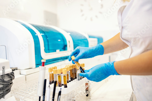 A test tubes with blood samples. A nurse standing in a laboratory and taking test tubes with blood samples ready for analysis. D-dimer and coagulation check during corona