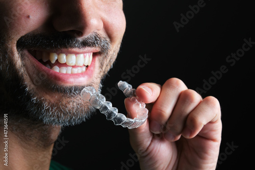 bearded guy putting on transparent dental retainer