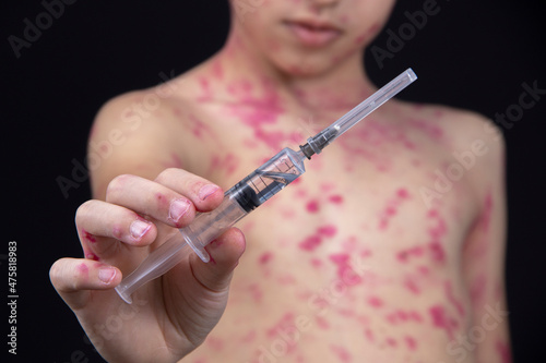 A boy is holding a syringe with a vaccine for the virus in his hand.