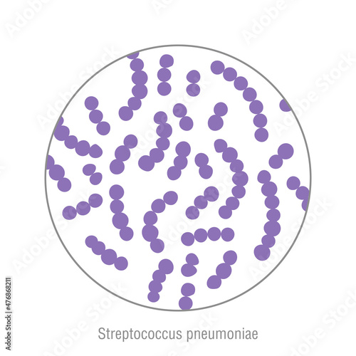 Streptococcus pneumoniae, pathogenic bacteria. Bacterial microorganism. Microbiology, infographic