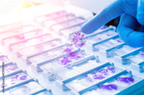 Hand in blue glove holding glass histology slides